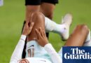 Nations League: Kylian Mbappé injured after scoring France winner in Turkey