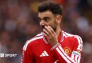 Leeds vs Man Utd participant scores: Dominic Calvert-Lewin denies Man Utd – who rated highest?